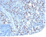 IHC staining of FFPE human lymph node tissue with recombinant LEF1 antibody (clone rLEF1/6906) at 2ug/ml in PBS for 30min RT. Strong nuclear staining of non-germinal center cells is observed. Negative control inset: PBS instead of primary antibody to control for secondary binding. HIER: boil tissue sections in pH 9 10mM Tris with 1mM EDTA for 20 min and allow to cool before testing.