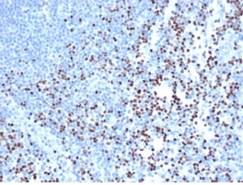 IHC staining of FFPE human lymph node with recombinant LEF1 antibody (clone rLEF1/6906) at 2ug/ml in PBS for 30min RT. Strong nuclear staining of non-germinal center observed. HIER: boil tissue sections in pH 9 10mM Tris with 1mM EDTA for 20 min and allow to cool before testing.~
