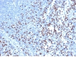 IHC staining of FFPE human lymph node with recombinant LEF1 antibody (clone rLEF1/6906) at 2ug/ml in PBS for 30min RT. Strong nuclear staining of non-germinal center observed. HIER: boil tissue sections in pH 9 10mM Tris with 1mM EDTA for 20 min and allow to cool before testing.