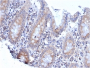 IHC staining of FFPE human colon tissue with recombinant RPSA antibody (clone rRPSA/6333). HIER: boil tissue sections in pH 9 10mM Tris with 1mM EDTA for 20 min and allow to cool before testing.
