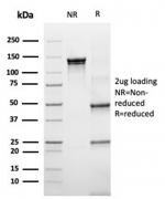 SDS-PAGE analysis of purified, BSA-free recombinant RPSA antibody (clone rRPSA/6333) as confirmation of integrity and purity.
