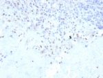 IHC staining of FFPE human lymph node with recombinant PU.1 antibody (clone rPU1/2146). HIER: boil tissue sections in pH 9 10mM Tris with 1mM EDTA for 20 min and allow to cool before testing.