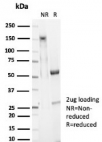 SDS-PAGE analysis of purified, BSA-free EpCAM antibody (clone EGP40/7025R) as confirmation of integrity and purity.