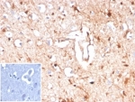 IHC staining of FFPE human brain tissue with S100B antibody (clone S100B/4143) at 2ug/ml. Negative control inset: PBS instead of primary antibody to control for secondary binding. HIER: boil tissue sections in pH 9 10mM Tris with 1mM EDTA for 20 min and allow to cool before testing.