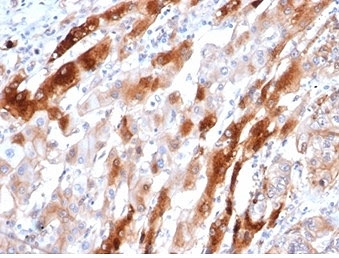 IHC staining of FFPE human liver tissue with GLUL antibody (clone GLUL/6604) at 2ug/ml. HIER: boil tissue sections in pH 9 10mM Tris with 1mM EDTA for 20 min and allow to cool before testing.