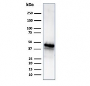Western blot testing of human Y79 cell lysate using GLUL antibody (clone GLUL/6604). Predicted molecular weight ~42 kDa.