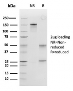 SDS-PAGE analysis of purified, BSA-free Peroxiredoxin 4 antibody (clone CPTC-PRDX4-2) as confirmation of integrity and purity.