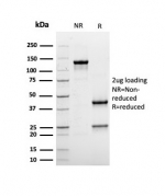 SDS-PAGE analysis of purified, BSA-free recombinant ALB antibody (clone rALB/6410) as confirmation of integrity and purity.