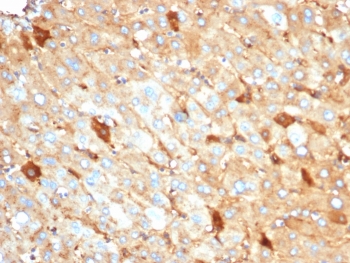 IHC staining of FFPE human liver tissue with recombinant ALB antibody (clone rALB/6410). HIER: boil tissue sections in pH 9 10mM Tris with 1mM EDTA for 20 min and allow to cool before testing.