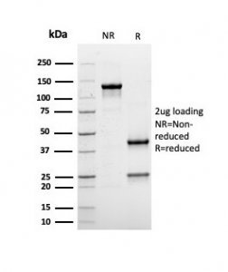 SDS-PAGE analysis of purified, BSA-free recombinant ALB antibody (clone rALB/6410) as confirmation of integrity and purity.