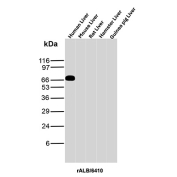 ALB Antibody Liver Tissue WB. Western blot analysis of human, mouse, rat, hamster, and guinea pig liver tissue lysates using ALB antibody detects a prominent band at approximately 65-70 kDa in human liver, consistent with the predicted molecular weight of Albumin (ALB), with minimal signal observed in other species under these conditions; detection was performed with clone rALB/6410.