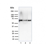 Western blot testing of human 1) T47-D, 2) SK-BR-3 and 3) A375 cell lysate using CSTF2T antibody (clone PCRP-CSTF2T-1A3). Predicted molecular weight ~64 kDa.