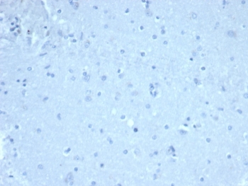 Negative control: IHC staining of FFPE human brain tissue using recombinant FOXP1 antibody (clone FOXP1/44R) at 1ug/ml. HIER: boil tissue sections in pH 9 10mM Tris with 1mM EDTA for 20 min and allow to cool before testing.