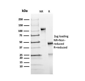 SDS-PAGE analysis of purified, BSA-free recombinant FOXP1 antibody (clone FOXP1/44R) as confirmation of integrity and purity.