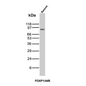 FOXP1 Antibody Ramos WB. Western blot analysis of Ramos cell lysate using recombinant FOXP1 Antibody clone FOXP1/44R. A distinct band is detected at approximately 85-90 kDa, consistent with the predicted molecular weight of Forkhead box protein P1 / FOXP1, a transcription factor involved in B-cell development, lymphocyte differentiation, and transcriptional regulation. The observed expression pattern aligns with the established expression of FOXP1 in B-cell lineage-derived Ramos cells.