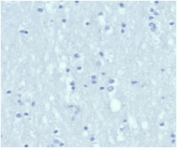 Negative control: IHC staining of FFPE human brain tissue using Cytokeratin 6A antibody (clone KRT6/3997R) at 2ug/ml in PBS for 30min RT. HIER: boil tissue sections in pH 9 10mM Tris with 1mM EDTA for 20 min and allow to cool before testing.