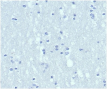 Negative control: IHC staining of FFPE h