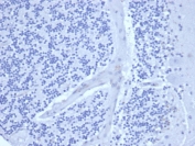 Negative control: IHC staining of FFPE human brain tissue using recombinant Ki-67 antibody (clone rMKI67/6499) at 2ug/ml in PBS for 30min RT. HIER: boil tissue sections in pH 9 10mM Tris with 1mM EDTA for 20 min and allow to cool before testing.