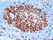 IHC staining of FFPE human tonsil tissue with recombinant Ki67 antibody (clone rMKI67/6499). HIER: boil tissue sections in pH 9 10mM Tris with 1mM EDTA for 20 min and allow to cool before testing.