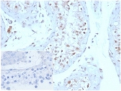 IHC staining of FFPE human testis tissue with GMNN antibody (clone GMNN/3665). Negative control inset: PBS instead of primary antibody to control for secondary binding. HIER: boil tissue sections in pH 9 10mM Tris with 1mM EDTA for 20 min and allow to cool before testing.