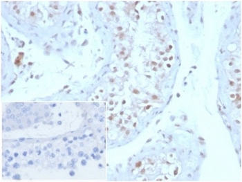 IHC staining of FFPE human testis tissue with GMNN antibody (clone GMNN/3665). Negative control inset: PBS instead of primary antibody to control for secondary binding. HIER: boil tissue sections in pH 9 10mM Tris with 1mM EDTA for 20 min and allow to cool before testing.