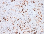 IHC staining of FFPE human pancreatic tissue with SOX9 antibody (clone SOX9/2104) HIER: boil tissue sections in pH 9 10mM Tris with 1mM EDTA for 20 min and allow to cool before testing.