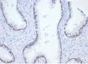 IHC staining of FFPE human tonsil tissue with recombinant Catenin Beta antibody (clone rCTNNB1/7358). HIER: boil tissue sections in pH 9 10mM Tris with 1mM EDTA for 20 min and allow to cool before testing.