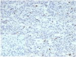 IHC staining of FFPE human spleen tissue with PRF1 antibody(clone PRF1/7077R). Negative control inset: PBS instead of primary antibody to control for secondary binding. HIER: boil tissue sections in pH 9 10mM Tris with 1mM EDTA for 20 min and allow to cool before testing.