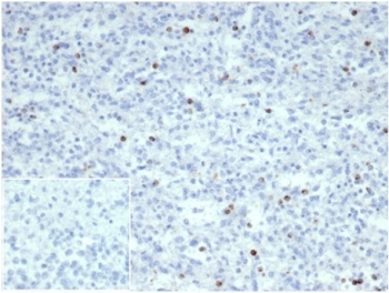 IHC staining of FFPE human spleen tissue with PRF1 antibody(clone PRF1/7077R). Negative control inset: PBS instead of primary an