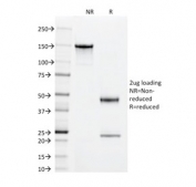 SDS-PAGE analysis of purified, BSA-free Superoxide Dismutase 1 antibody (clone SOD1/2089) as confirmation of integrity and purity.