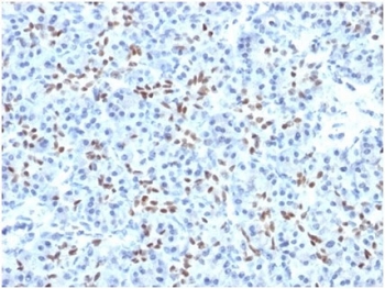 IHC staining of FFPE human pancreatic tissue with SOX9 antibody (clone PCRP-SOX9-1A2). HIER: boil tissue sections in pH 9 10mM Tris with 1mM EDTA for 20 min and allow to cool before testing.