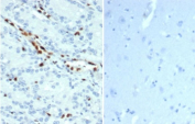 ERG Antibody Human Prostate Tissue IHC. Immunohistochemistry staining of FFPE human prostate tissue (left) and negative control human brain tissue (right) with ERG antibody (clone ERG/22R) at 1ug/ml. HIER: boil tissue sections in pH 9 10mM Tris with 1mM EDTA for 20 min and allow to cool before testing.