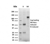 SDS-PAGE analysis of purified, BSA-free recombinant ERG antibody (clone ERG/22R) as confirmation of integrity and purity.