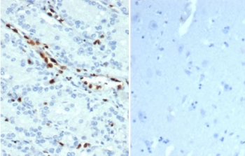 IHC staining of FFPE human prostate tissue (left) and negative control human brain tissue (right) with recombinant ERG antibody (clone ERG/22R) at 1ug/ml. HIER: boil tissue sections in pH 9 10mM Tris with 1mM EDTA for 20 min and allow to cool before testing.~