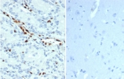 IHC staining of FFPE human prostate tissue (left) and negative control human brain tissue (right) with recombinant ERG antibody (clone ERG/22R) at 1ug/ml. HIER: boil tissue sections in pH 9 10mM Tris with 1mM EDTA for 20 min and allow to cool before testing.