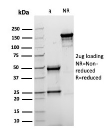 SDS-PAGE analysis of purified, BSA-free recombinant Topoisomerase II alpha antibody (clone rTOP2A/6629) as confirmation of integrity and purity.