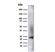 Western blot testing of human HeLa cell lysate using CBFB antibody (clone PCRP-CBFB-1F6). Predicted molecular weight ~22 kDa.