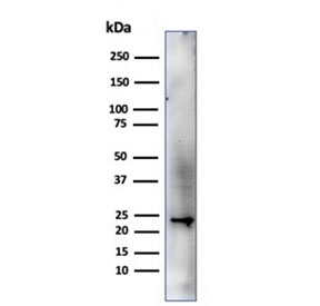Western blot testing of human HeLa cell lysate using CBFB antibody (clone PCRP-CBFB-1F6). Predicted molecular weight ~22 kDa.