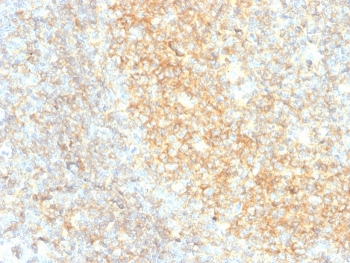 IHC staining of FFPE human tonsil tissue with recombinant CD40 antibody (clone C40/4826R). HIER: boil tissue sections in pH 9 10mM Tris with 1mM EDTA for 20 min and allow to cool before testing.