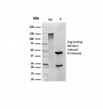 SDS-PAGE analysis of purified, BSA-free S100B antibody (S100B/4139) as confirmation of integrity and purity.