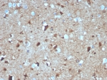 IHC staining of FFPE human brain tissue with S100B antibody (clone S100B/4139). HIER: boil tissue sections in pH 9 10mM Tris with 1mM EDTA for 20 min and allow to cool before testing.