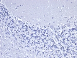 Negative control: IHC staining of FFPE human brain tissue with recombinant KRT8 antibody (clone rKRT8/6471) at 2ug/ml in PBS for 30min RT. HIER: boil tissue sections in pH 9 10mM Tris with 1mM EDTA for 20 min and allow to cool before testing.