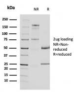 SDS-PAGE analysis of purified, BSA-free Uroplakin 1A antibody (clone UPK1A/2924) as confirmation of integrity and purity.
