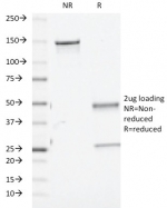 SDS-PAGE analysis of purified, BSA-free TGF beta 1/2/3 antibody (clone TGFB/510) as confirmation of integrity and purity.