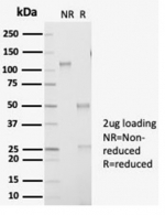 SDS-PAGE analysis of purified, BSA-free recombinant AKR1B1 antibody (AKR1B1/7009R) as confirmation of integrity and purity.