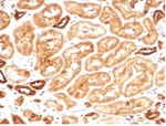 IHC staining of FFPE human kidney tissue with recombinant AKR1B1 antibody (clone AKR1B1/7009R). HIER: boil tissue sections in pH 9 10mM Tris with 1mM EDTA for 20 min and allow to cool before testing.
