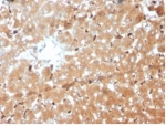 IHC staining of FFPE human liver tissue with Haptoglobin antibody (clone HP/3839) at 2ug/ml. HIER: boil tissue sections in pH 9 10mM Tris with 1mM EDTA for 20 min and allow to cool before testing.