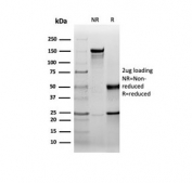 SDS-PAGE analysis of purified, BSA-free recombinant HSPB1 antibody (clone rHSPB1/6489) as confirmation of integrity and purity.