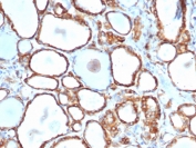 IHC staining of FFPE human thyroid with recombinant HSPB1 antibody (clone rHSPB1/6489). HIER: boil tissue sections in pH 9 10mM Tris with 1mM EDTA for 20 min and allow to cool before testing.