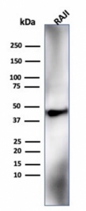Western blot testing of human Raji cell lysate using HLA-G antibody (clone HLAG/6686).